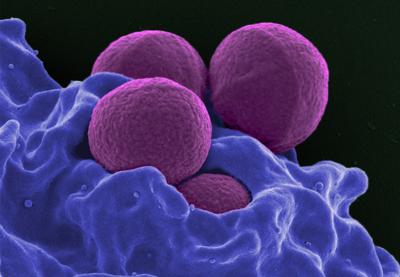 MRSA resistant bacteria