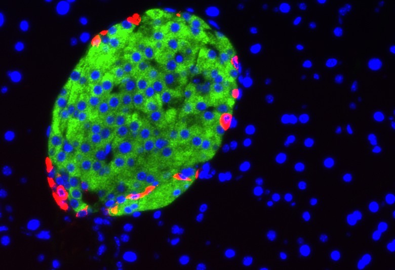 Miniature messenger molecules released by cells in the pancreas (green) may hold the key to early diagnosis of diabetes