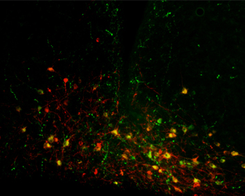 Metabolic Signalling