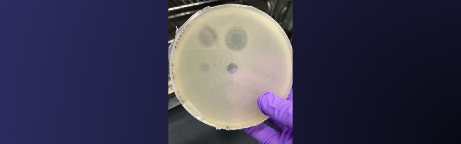 Archaea can kill bacteria with new antibacterials