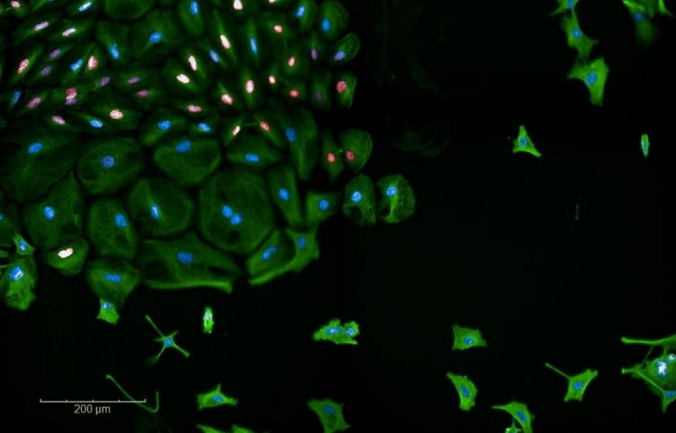 fluorescent image of cells