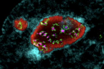 3D super resolution image of an ES cell nucleus showing nucleolar compartments (red, green,pink), by Sheila Xie and Chad Whilding