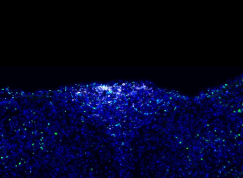 Endocrine Signalling in Inflammation