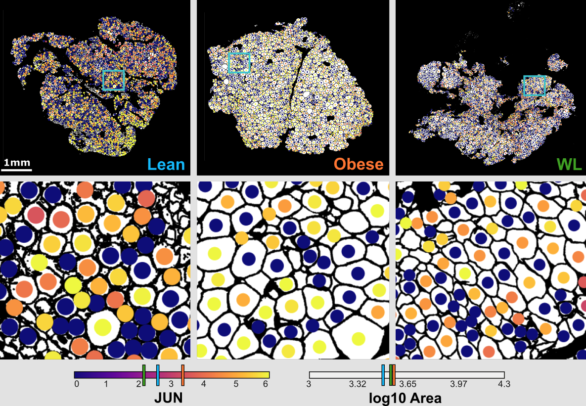 Genomics of obesity fig 3 cell size stress