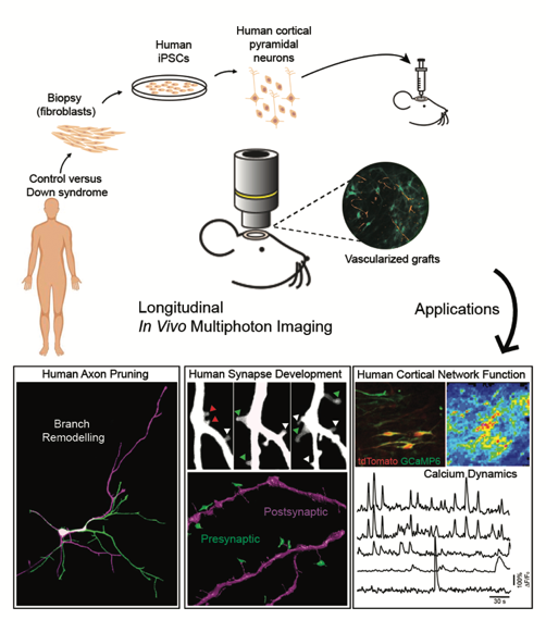 Human neuron dynamics imaged in vivo