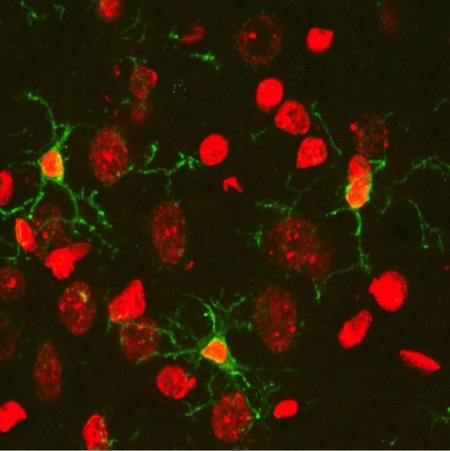 Microglial cells in schizophrenia