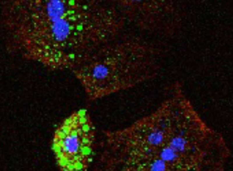 Metabolism and gene regulation