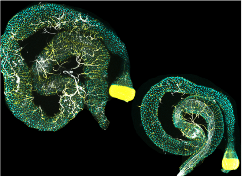 Organ organisation: why sex-based differences in the size, shape, and position of the gut matter