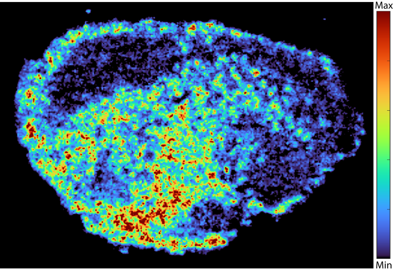 Figure shows mass spectrometry imaging of the PARP inhibitor niraparib in human ovarian tumour tissue. Warmer colours show regions of high drug accumulation or ‘hotspots’, while cooler colours show regions with lower drug levels. 