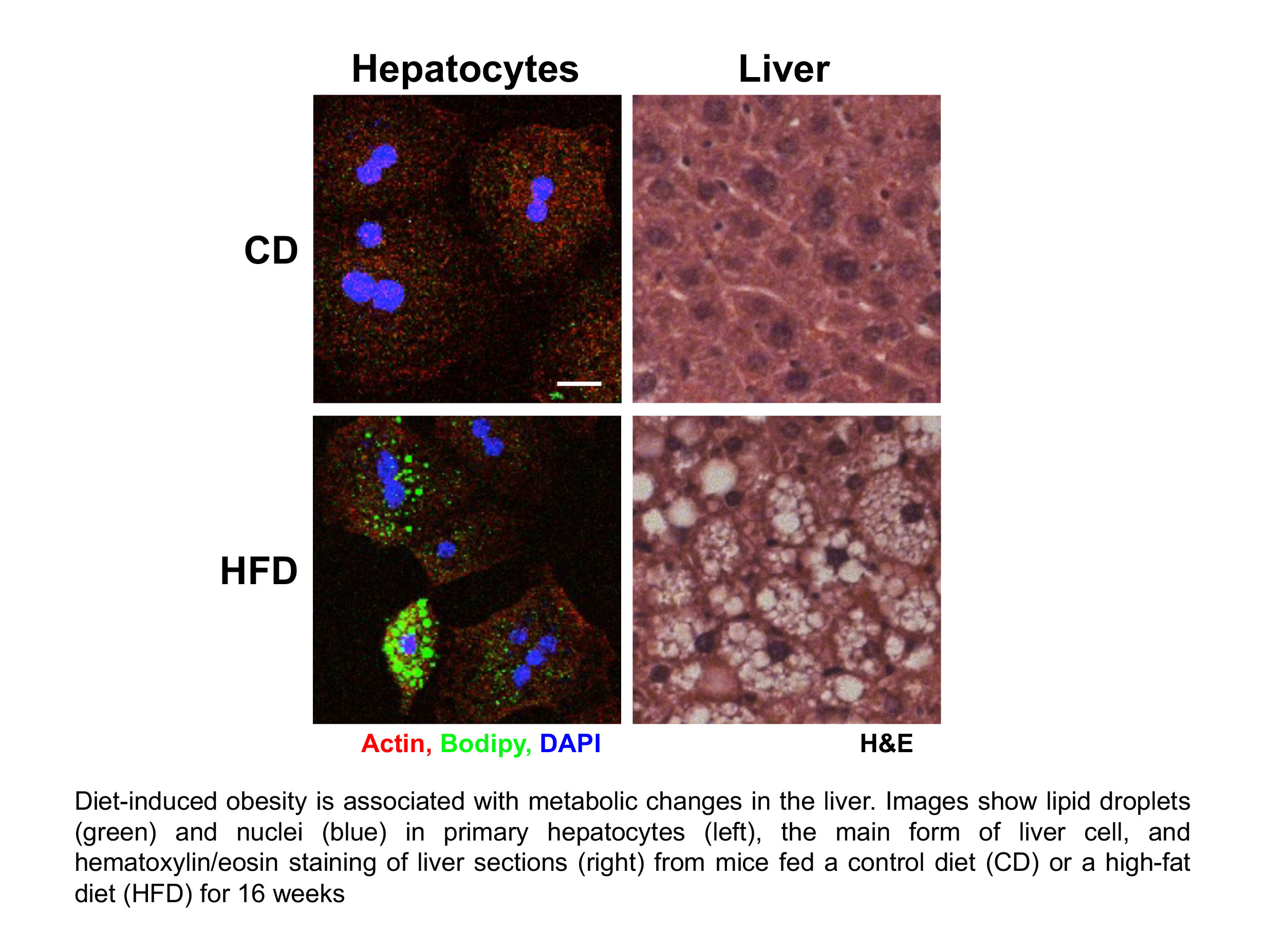 Chart showing Hepatocytes, liver, CD, HFD being compared