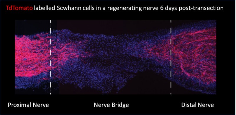 Definition of Schwann cell transcriptome clarifies key role in nerve repair