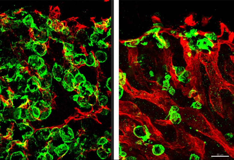 Images from the study showing fat accumulating around bone blood vessels.