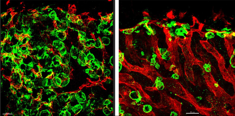Images from the study showing fat accumulating around bone blood vessels.