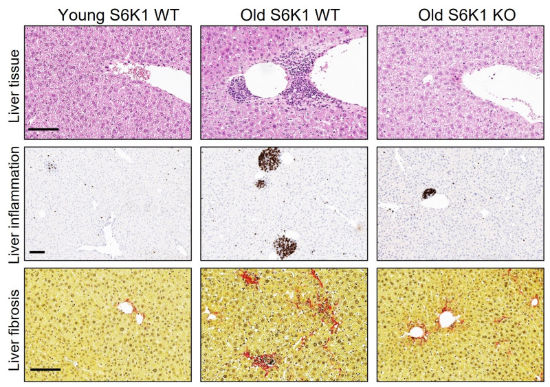 Staining of liver sections from young wild-type mice (left), old wild-type mice (middle) and old mice lacking S6K1 protein (right) showing how alterations in tissue morphology (top) and increases in inflammation (middle) and fibrosis (scar tissue, bottom) in the old wild-type mice are prevented in mice lacking S6K1. Scale bar, 100 μm.