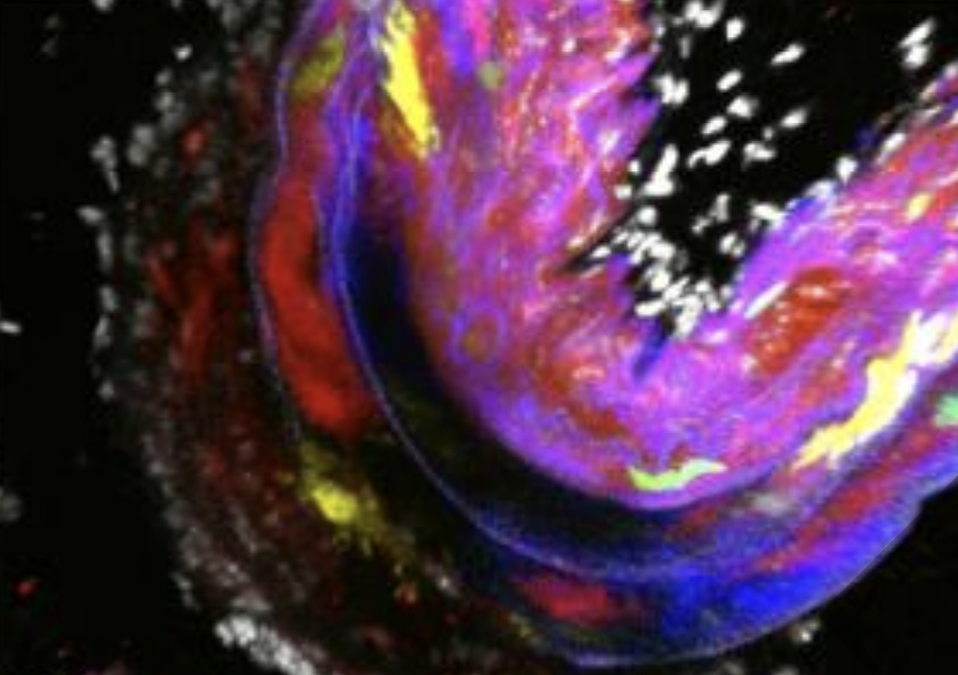 Modified Smooth Muscle Cells Of Afferent Arteriole