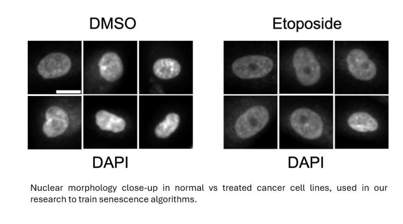 Nuclear morphology close up