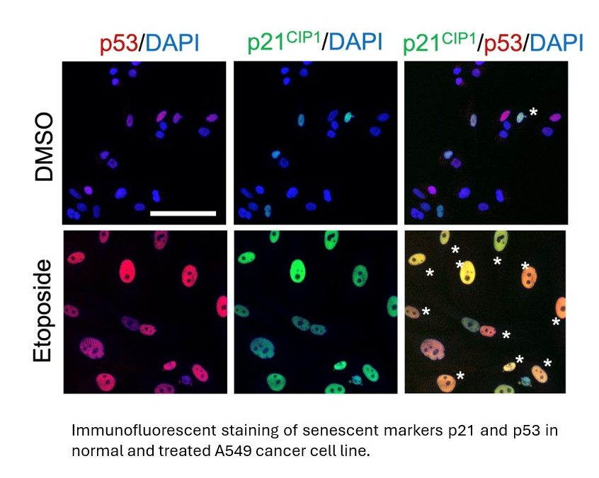 Immunofluorescent staining of senescent markers