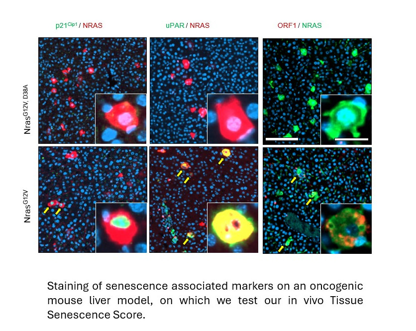 Staining of senescence associated markers on an oncogenic mouse liver model