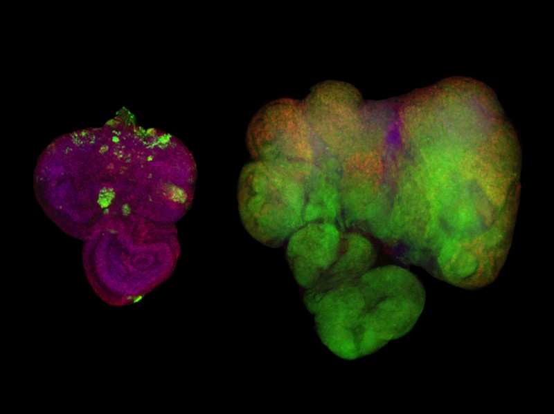 Metabolism and Cell Growth