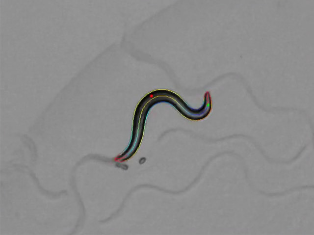 C elegans worm