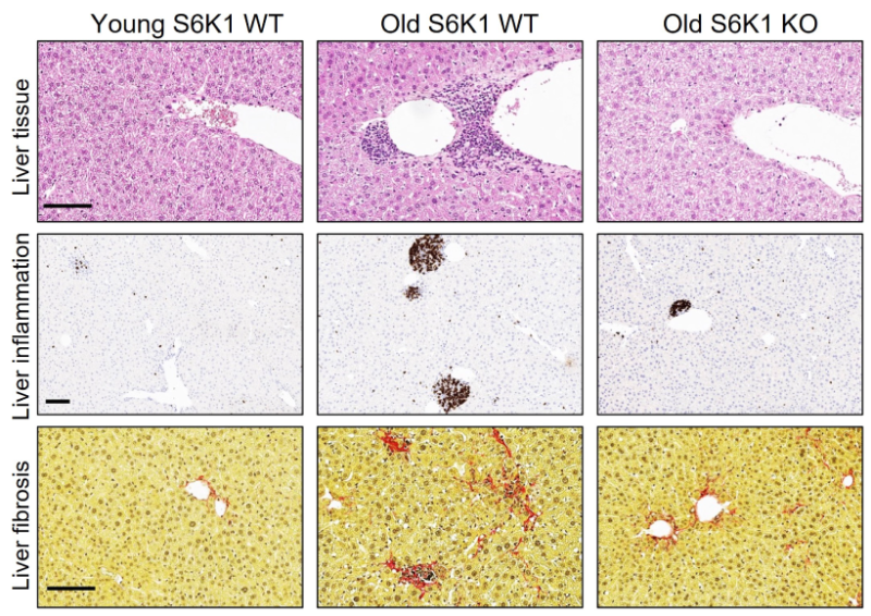 blocking-the-longevity-gene-s6k1-blog-image