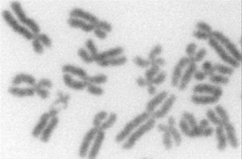 Just like your Mother? Competition between X chromosomes shapes who we are.