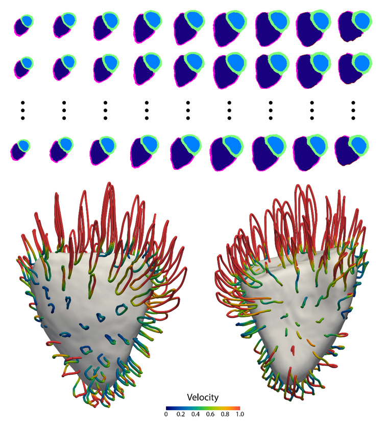 Machine learning cardiac motion analysis of patients diagnosed with right heart failure is used for automated survival prediction (DOI:10.1038/s42256-019-0019-2).