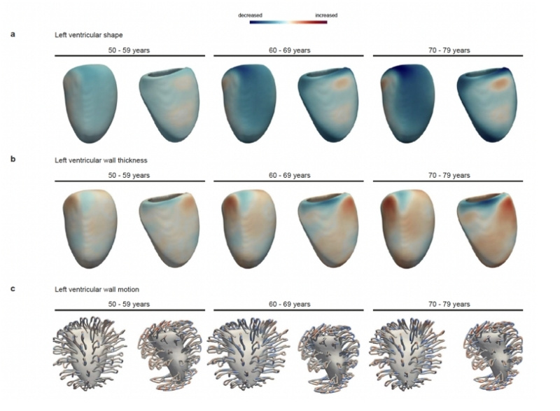 Imaging data used by researchers along with AI to calculate ‘Heart Age’