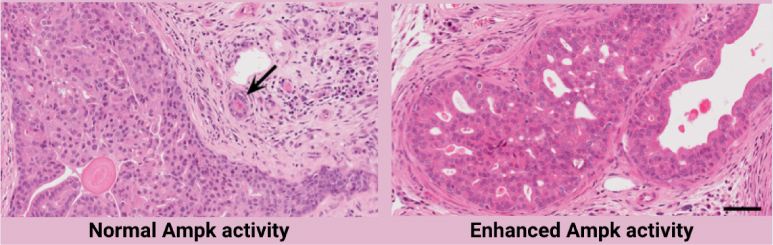 Using a clinically relevant mouse model, researchers found that mice with enhanced Ampk activity (right) had significantly less prostate cancer than mice with normal Ampk activity (left). An example of prostate cancer is indicated by an arrow.