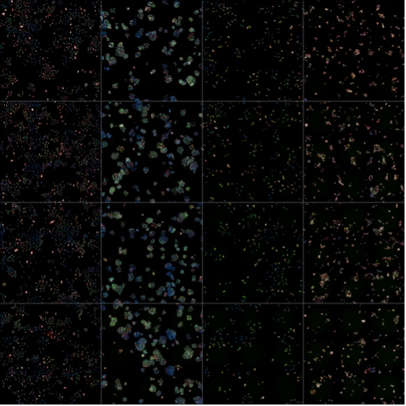 Representative images of thousands of Non-Small Cell Lung Cancer cells were used to help train and test the new machine learning approach to accurately identify sleeping cell states.