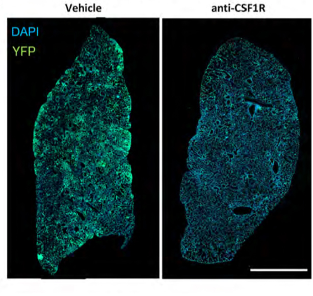 In mice, the removal of senescent macrophages resulted in a reduction in tumour lesions (shown in green).