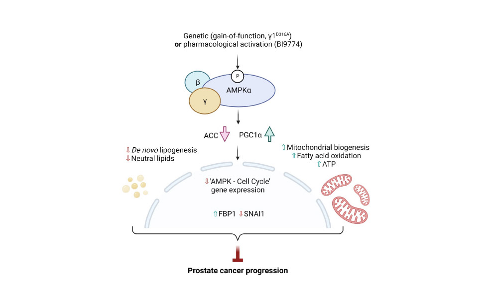 prostate cancer progression diagram