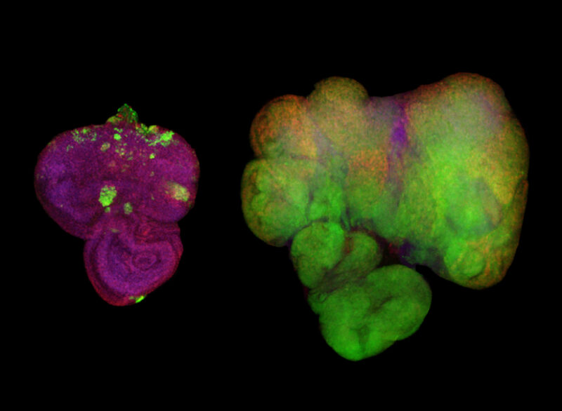 Metabolism and cell growth