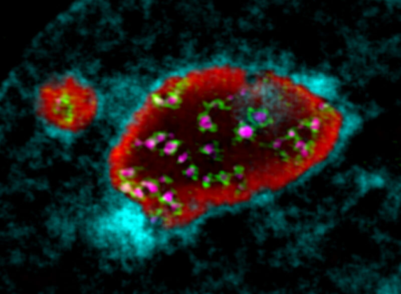 Metabolism and gene regulation