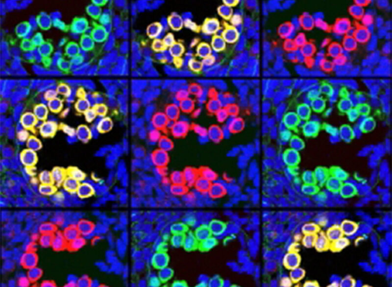 Reprogramming and chromatin