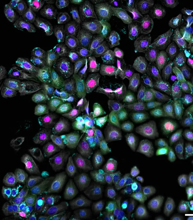 Drug transport and tumour metabolism