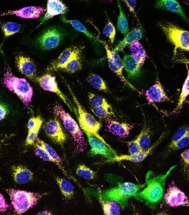 Lymphocyte development