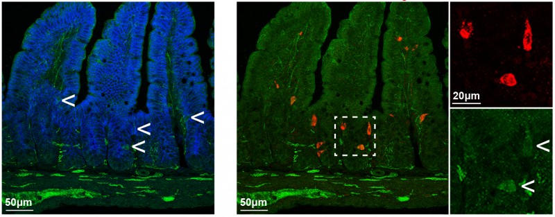 Flies help gut scientists shed light on human disease