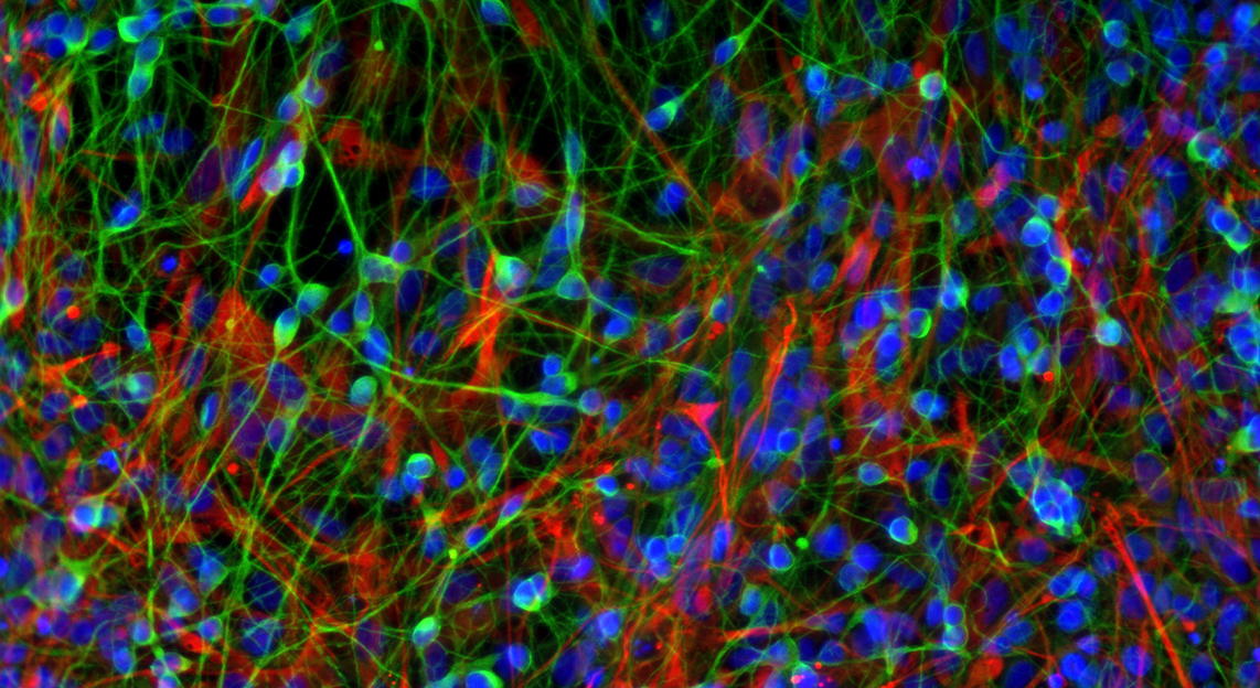 Gene dysfunction in human CdLS may result from abnormal genome folding