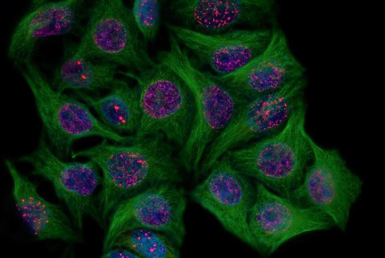 Human cells entering senescence