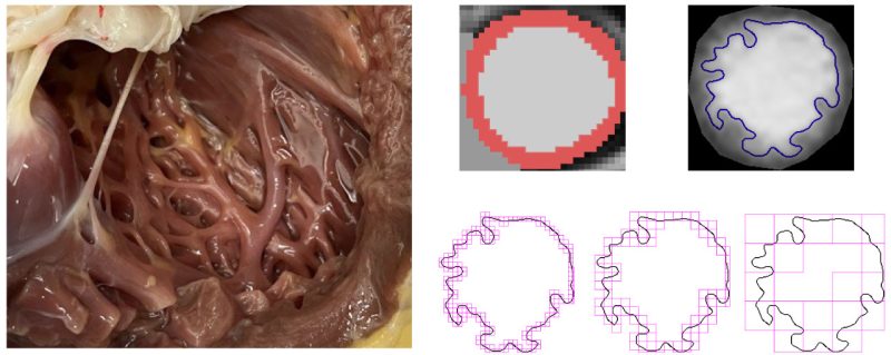 A cut section of the heart showing the intricate trabecular muscles (left) and machine learning analysis of heart imaging which detects trabeculae and measures their complexity (right). Left image taken from Arpatsara/Shutterstock.com.